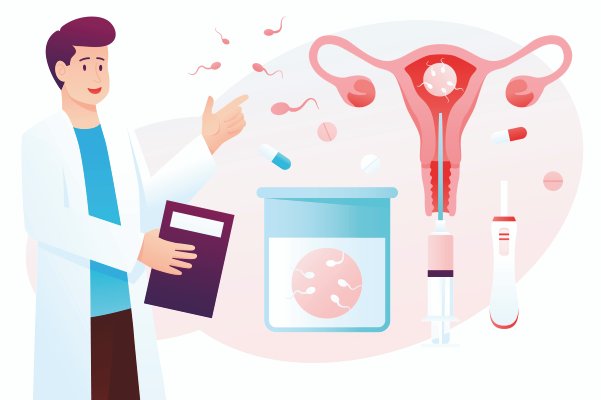 Intrauterine insemination procedure