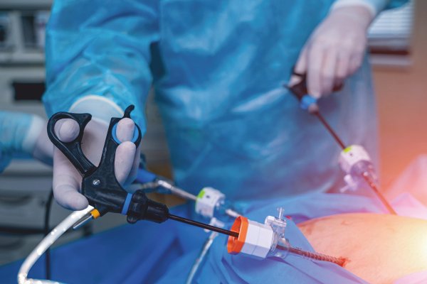 Laparoscopy procedure for fertility