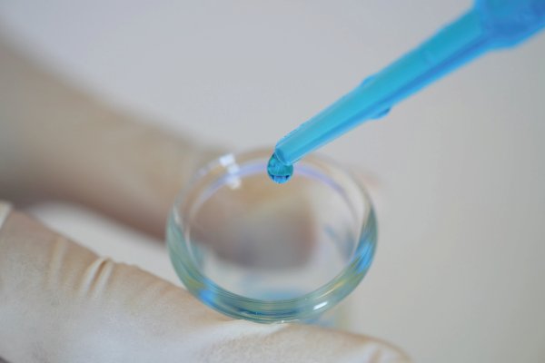 Laser Assisted Hatching (LAH) on embryo in IVF lab