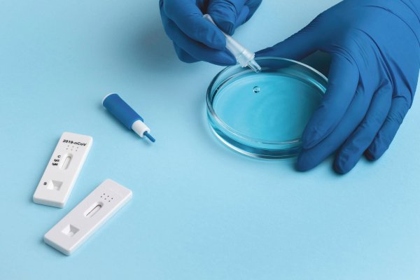 Microfluidic sperm sorting for IVF in embryology lab