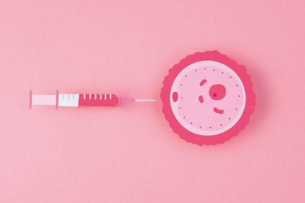 Ovarian Platelet Rich Plasma (PRP) Therapy in fertility clinic